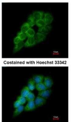 Immunocytochemistry/ Immunofluorescence: DARS Antibody [NBP1-33689]