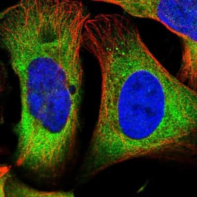 Immunocytochemistry/ Immunofluorescence: DARS Antibody [NBP1-86027]