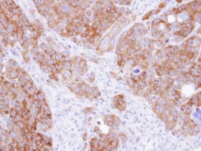 Immunohistochemistry-Paraffin: DARS Antibody [NBP1-33689]