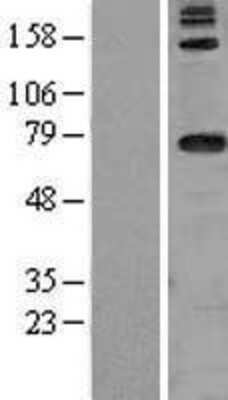 Western Blot: DARS2 Overexpression Lysate [NBL1-09721]