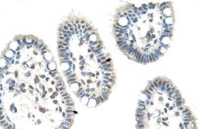 Immunohistochemistry-Paraffin: DAX1/NR0B1 Antibody [NBP1-52822]