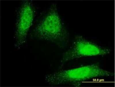 Immunocytochemistry/ Immunofluorescence: DAZ1 Antibody (3G10) [H00001617-M01]