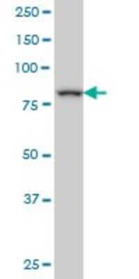 Western Blot: DAZ1 Antibody (4F3) [H00001617-M04]