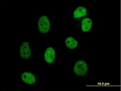 Immunocytochemistry/ Immunofluorescence: DAZAP1 Antibody [H00026528-B01P]