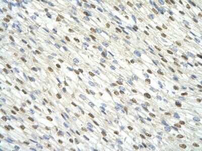 Immunohistochemistry: DAZAP1 Antibody [NBP1-57255]