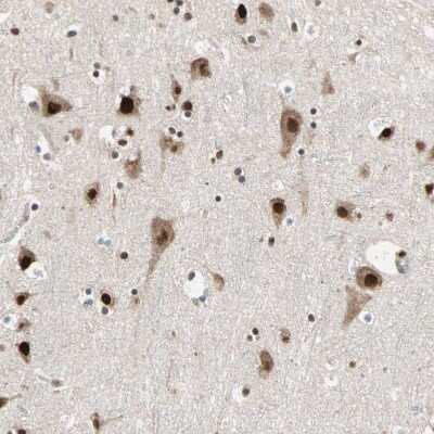 Immunohistochemistry-Paraffin: DAZAP1 Antibody [NBP1-82741]