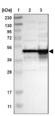 Western Blot: DAZAP1 Antibody [NBP1-82741]