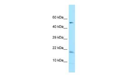 Western Blot: DAZAP2 Antibody [NBP2-87246]