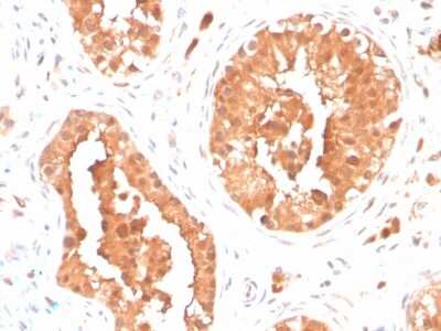 Immunohistochemistry-Paraffin: DAZL Antibody (DAZL/4253) - Azide and BSA Free [NBP3-08742]