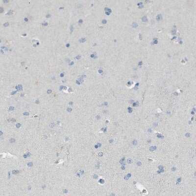Immunohistochemistry-Paraffin: DAZL Antibody [NBP1-85306]