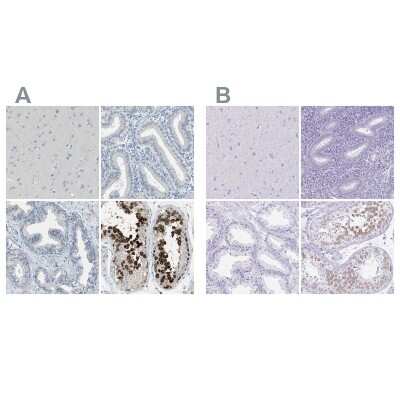 Immunohistochemistry-Paraffin: DAZL Antibody [NBP1-85306]