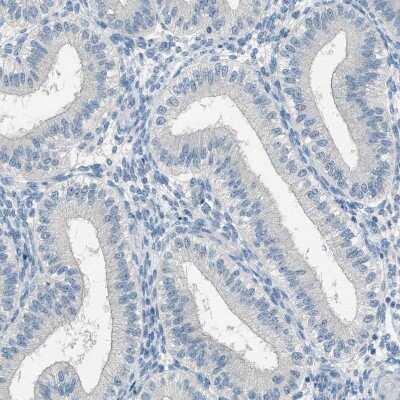 Immunohistochemistry-Paraffin: DAZL Antibody [NBP1-85306]