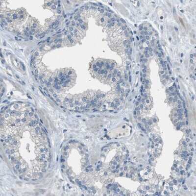 Immunohistochemistry-Paraffin: DAZL Antibody [NBP1-85306]