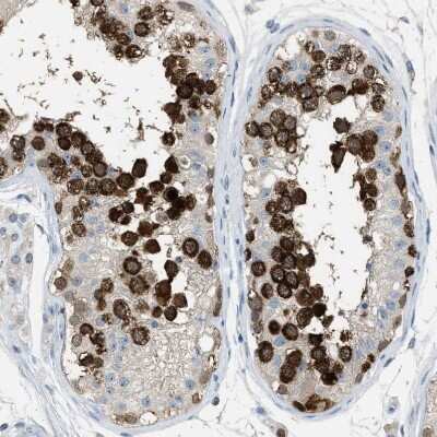 Immunohistochemistry-Paraffin: DAZL Antibody [NBP1-85306]