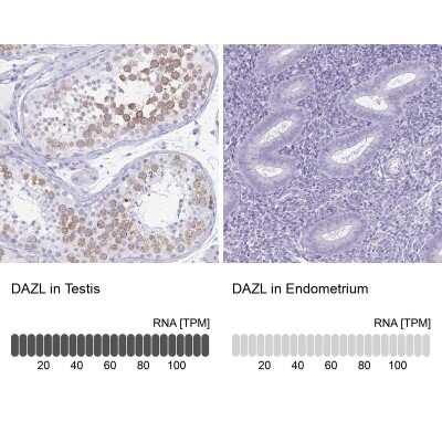 Immunohistochemistry-Paraffin: DAZL Antibody [NBP1-85307]