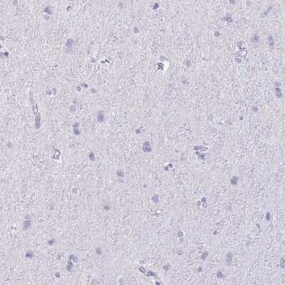 Immunohistochemistry-Paraffin: DAZL Antibody [NBP1-85307]