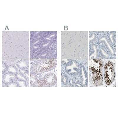 Immunohistochemistry-Paraffin: DAZL Antibody [NBP1-85307]