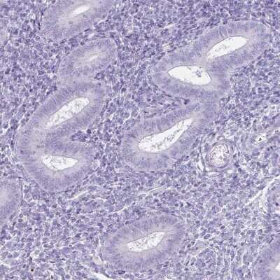 Immunohistochemistry-Paraffin: DAZL Antibody [NBP1-85307]