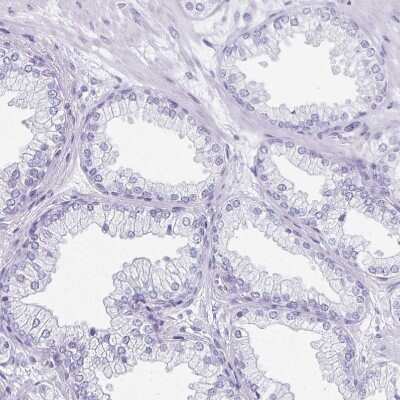 Immunohistochemistry-Paraffin: DAZL Antibody [NBP1-85307]