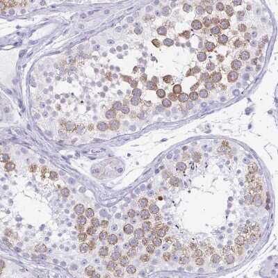 Immunohistochemistry-Paraffin: DAZL Antibody [NBP1-85307]