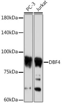 Western Blot: DBF4 Antibody (0S8I5) [NBP3-15903]