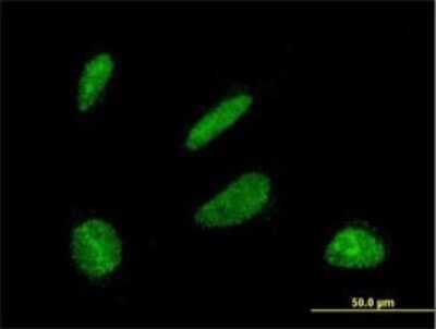 Immunocytochemistry/ Immunofluorescence: DBF4 Antibody (6G9) [H00010926-M01]