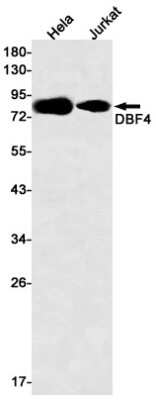 Western Blot: DBF4 Antibody (S06-6I2) [NBP3-15021]
