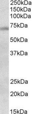 Western Blot: DBF4 Antibody [NBP1-78282]