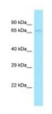 Western Blot: DBF4 Antibody [NBP1-98390]