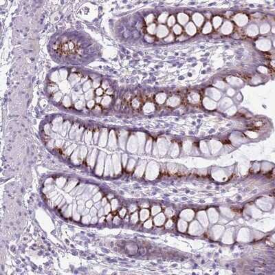 Immunohistochemistry-Paraffin: DBF4B Antibody [NBP2-13900]