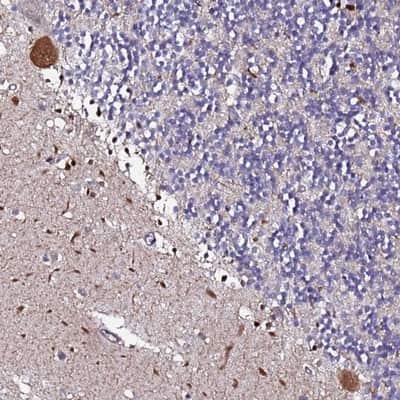 Immunohistochemistry-Paraffin: DBNDD2 Antibody [NBP1-91819]