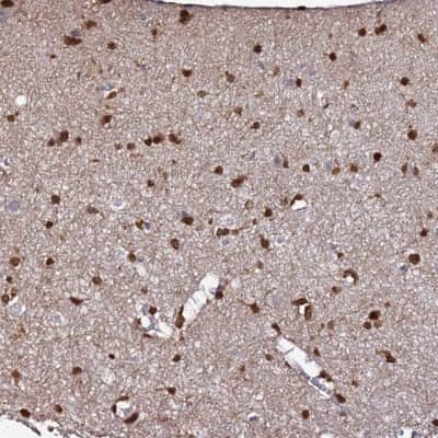Immunohistochemistry-Paraffin: DBNDD2 Antibody [NBP1-91819]