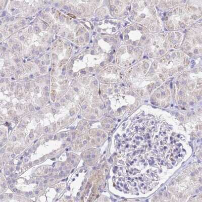 Immunohistochemistry-Paraffin: DBNDD2 Antibody [NBP1-91819]