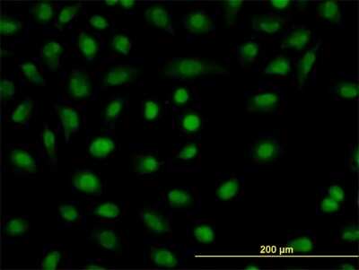 Immunocytochemistry/ Immunofluorescence: DBPA Antibody (1H5) [H00008531-M06]