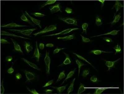 Immunocytochemistry/ Immunofluorescence: DBR1 Antibody (3A7) [H00051163-M01]
