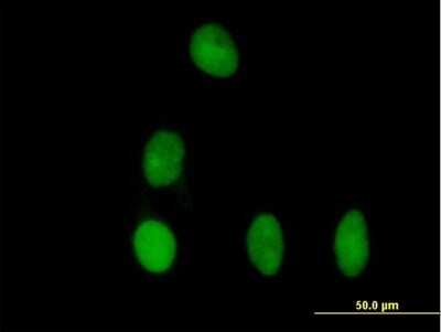 Immunocytochemistry/ Immunofluorescence: DBR1 Antibody [H00051163-B01P]
