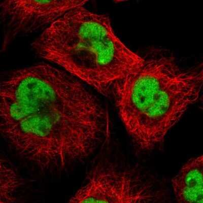 Immunocytochemistry/ Immunofluorescence: DBR1 Antibody [NBP1-85907]