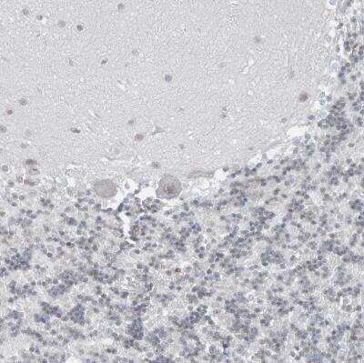 Immunohistochemistry-Paraffin: DBR1 Antibody [NBP1-85907]