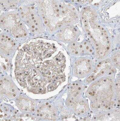 Immunohistochemistry-Paraffin: DBR1 Antibody [NBP1-85907]