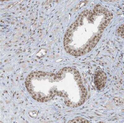 Immunohistochemistry-Paraffin: DBR1 Antibody [NBP1-85907]