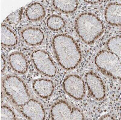 Immunohistochemistry-Paraffin: DBR1 Antibody [NBP1-85907]