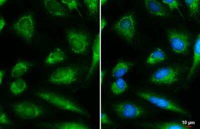 Immunocytochemistry/ Immunofluorescence: DBT Antibody [NBP1-31760]