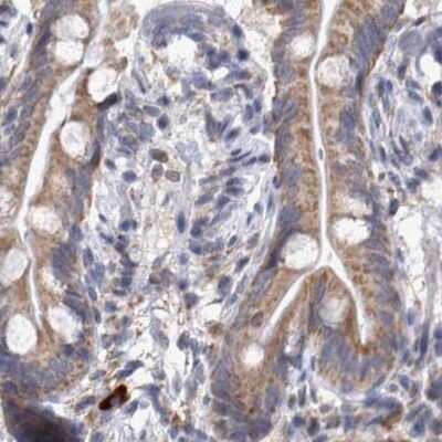 Immunohistochemistry-Paraffin: DBT Antibody [NBP1-85963]