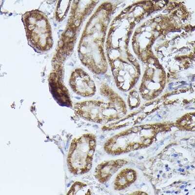 Immunohistochemistry-Paraffin: DBT Antibody - Azide and BSA Free [NBP3-16010]