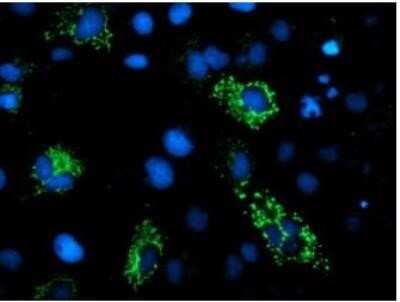 Immunocytochemistry/ Immunofluorescence: DBT Antibody (OTI1G2) - Azide and BSA Free [NBP2-70553]
