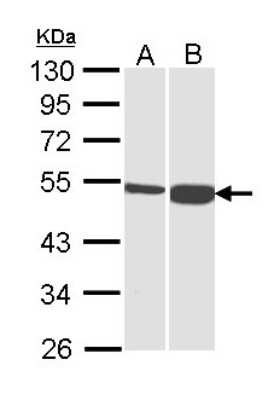 Western Blot: DBT Antibody [NBP1-31760]