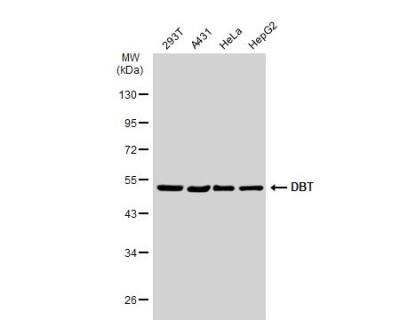 Western Blot: DBT Antibody [NBP1-31760]