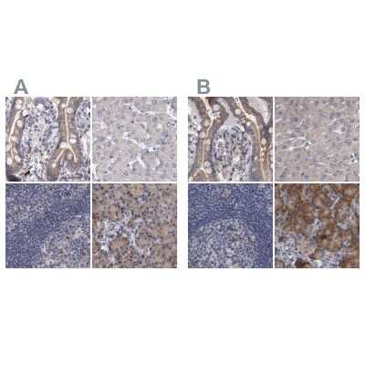 DBT Antibody