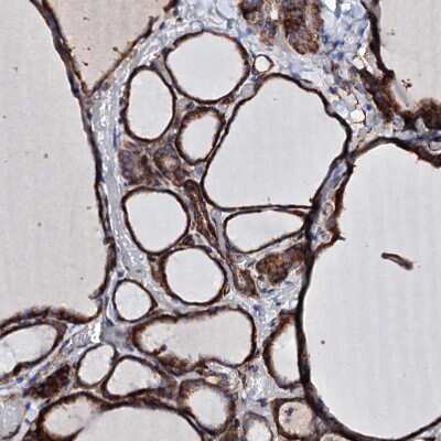 Immunohistochemistry-Paraffin: DBX1 Antibody [NBP1-90978]