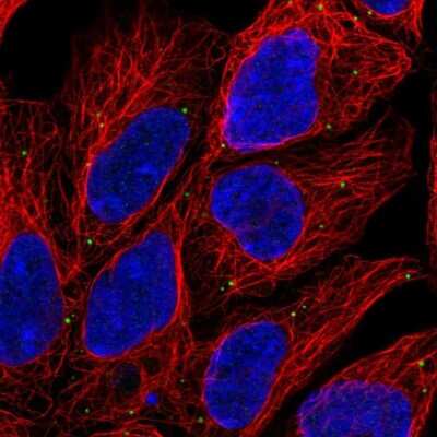 Immunocytochemistry/ Immunofluorescence: DC-LAMP Antibody [NBP2-33616]